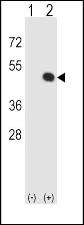 HLA-E antibody, Internal