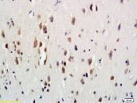 GCSF Receptor antibody