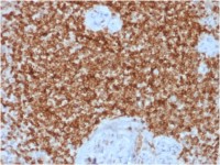 Bcl-2 antibody [BCL2/1878R]