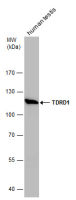 TDRD1 antibody