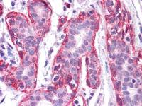 FRK antibody [1A8H2C12]