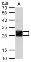 beta A3 Crystallin antibody [N1C3]