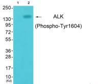 ALK (phospho Tyr1604) antibody