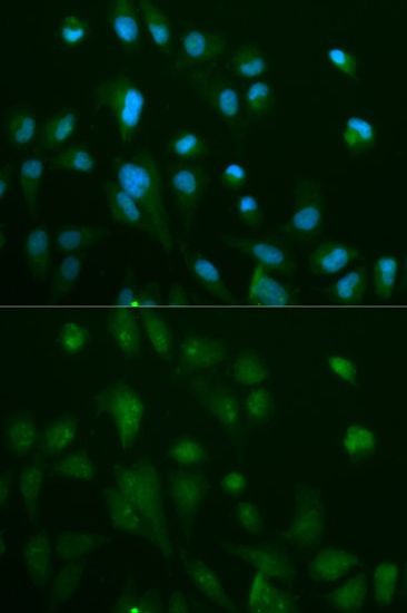 beta Arrestin 1 antibody