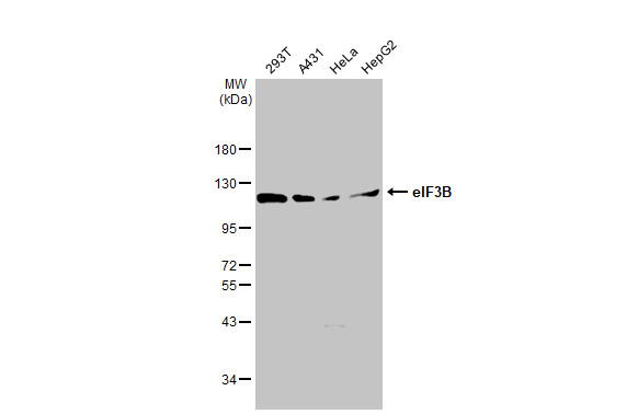 eIF3B antibody [GT1325]