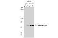 Leptin Receptor antibody [GT1233]