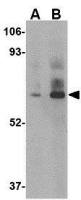 DHX58 antibody