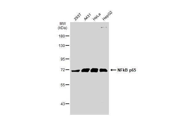 NFkB p65 antibody [GT1185]