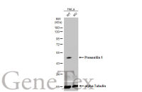 Presenilin 1 antibody [C1C2], Internal