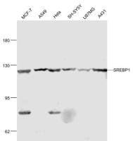 SREBP1 + SREBP2 antibody
