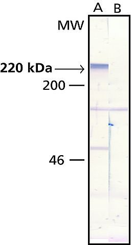 MAP2 antibody [AP-20]