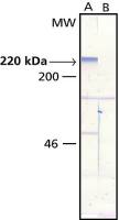 MAP2 antibody [AP-20]