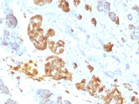 TNF alpha antibody [P/T2]
