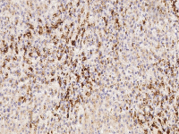 VEGFA antibody [13]