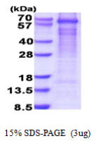 Human GAD67 protein, His tag