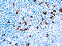 Rabbit Anti-Human IgA antibody