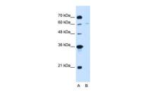 CHAF1B antibody, C-term