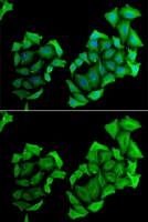 C4 binding protein B antibody