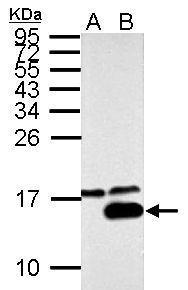 Galectin 7 antibody