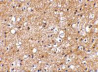 SP110 antibody