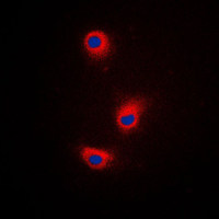 TRP2 antibody