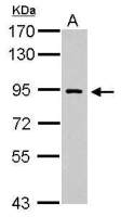 DNA polymerase iota antibody
