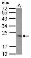 4-1BBL / CD137L antibody [N2C3]