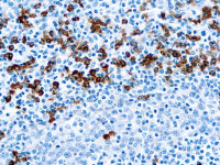 Rabbit Anti-Human IgG antibody