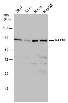 NAT10 antibody