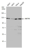 NAT10 antibody