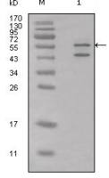 Calreticulin antibody