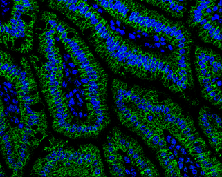 alpha Catenin antibody [N1N3]