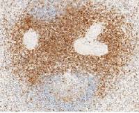 CD3 delta antibody [6B1C12F3]