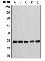 p27 Kip1 (phospho Thr198) antibody