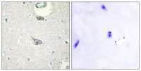 CADM4 antibody