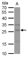 FGF18 antibody