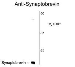 Synaptobrevin antibody [SP10]