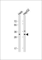 CTHRC1 antibody, N-term