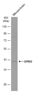GPR52 antibody
