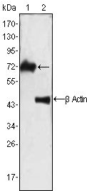 ZAP70 antibody [3D2A4]