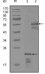 Her3 / ErbB3 antibody [3F10F6]