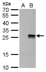 nm23-H6 antibody