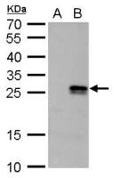 nm23-H6 antibody