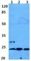 Ephrin A2 antibody