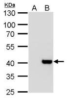 Macro H2A.2 antibody [N3C3]