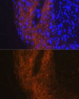 IL1 Receptor antagonist antibody