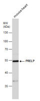 PRELP antibody