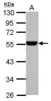 ALDH1A1 antibody