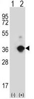 ANGPTL7 antibody, N-term