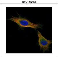 TPX2 antibody